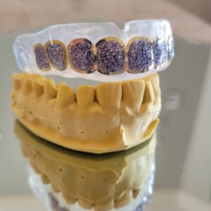 Royal Bite – Grillz