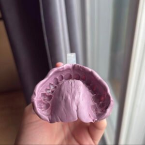 Self-Impression Replacement Set 2.0